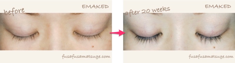 まつげ美容液 エマーキット の効果を体験レビュー 5ヶ月使用した経過を画像つきで検証レポート まつげの女神さま