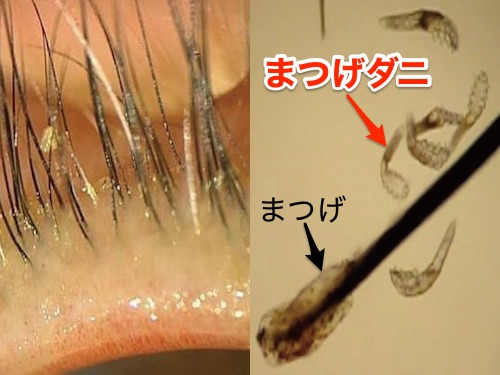 様々な画像 ユニーク 子供 まつ毛 抜く